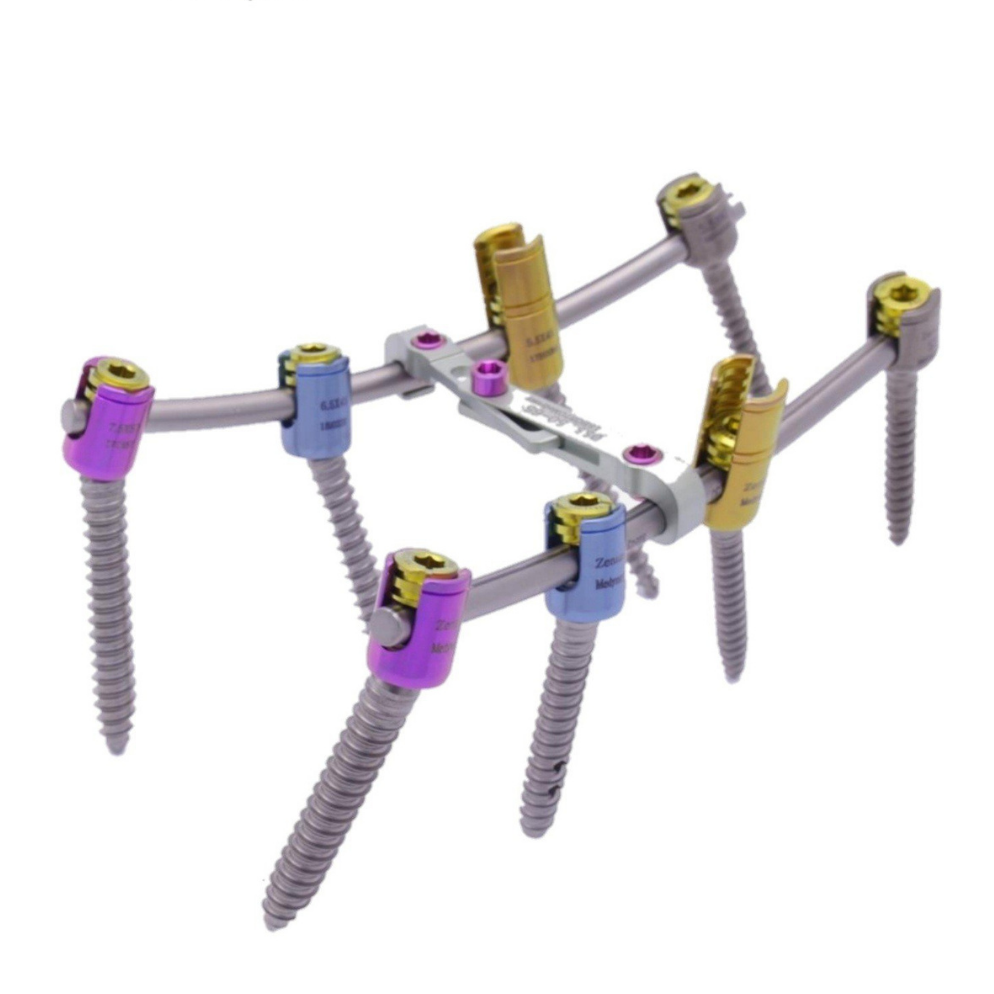 ZENIUS™ Sistema de Fijación Espinal