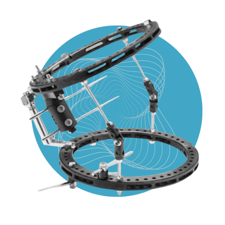 Sistema de Fijador Híbrido