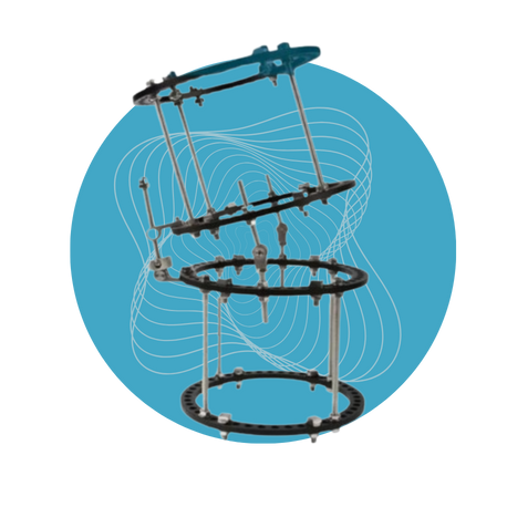 Sistema de Anillos TK-Ilizarov