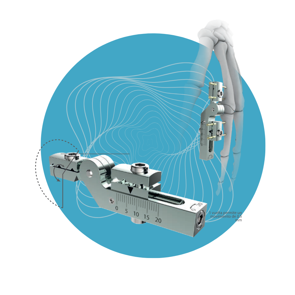 EF-03 - Set de Mini Fijador