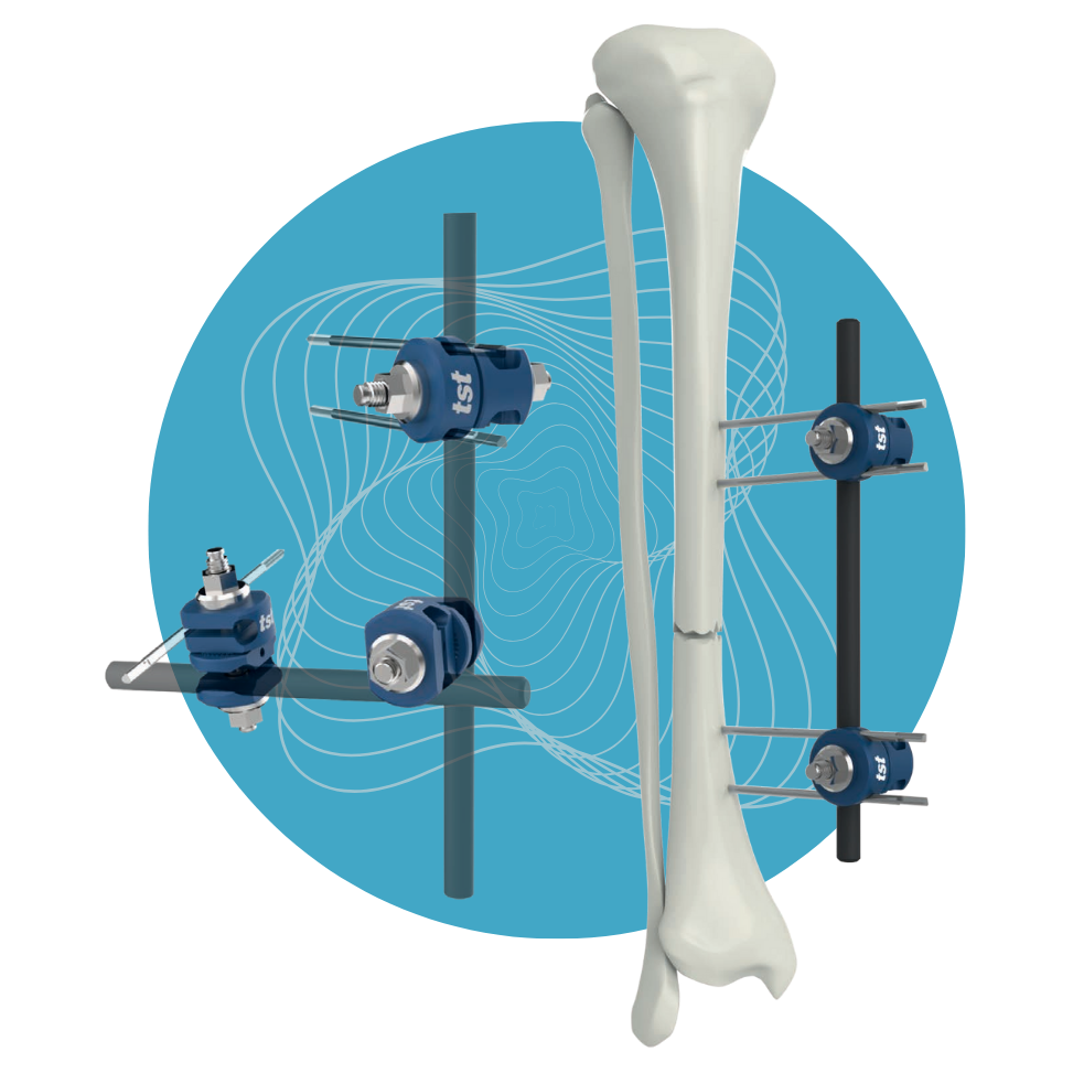 EF-08 - Set de Fijador UMEF