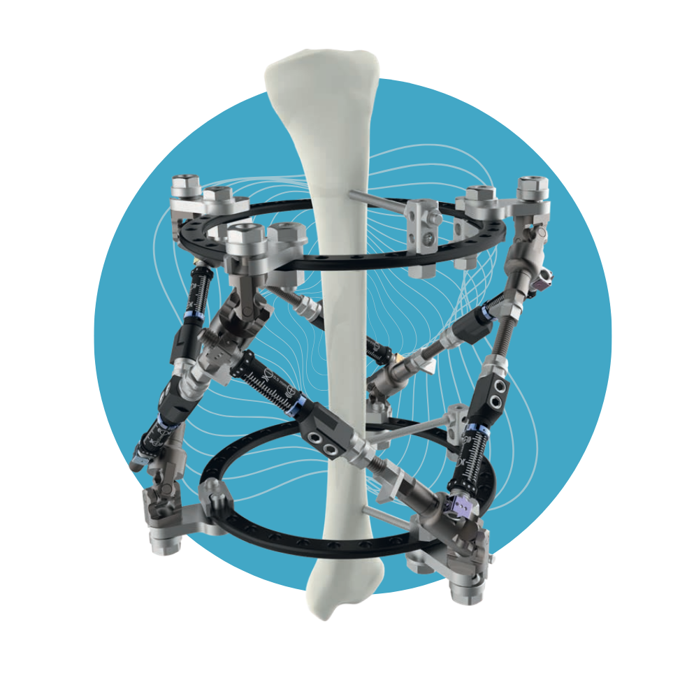 EF-17 - Set de Fijador Mini Frame Ortho-SUV