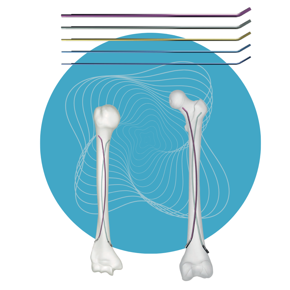 NL-07 - Set de Clavo Elástico de Titanio (TEP)