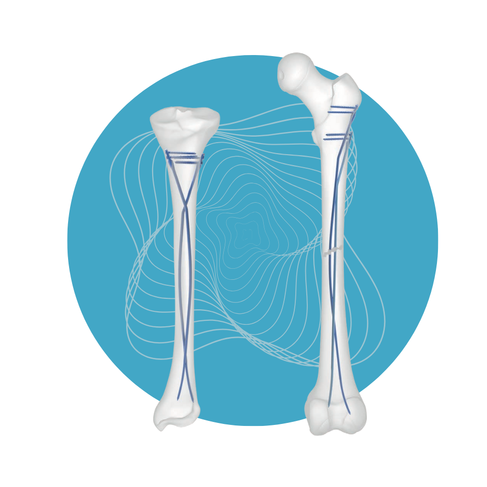 NL-09 - Set L-TEP 4.0-5.0mm