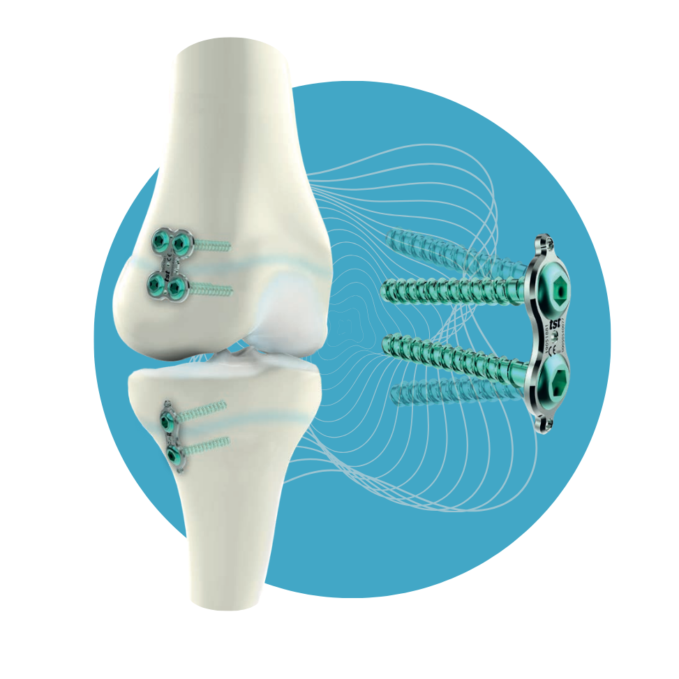 PD-03 - Set de Placas de Crecimiento Eight de Titanio