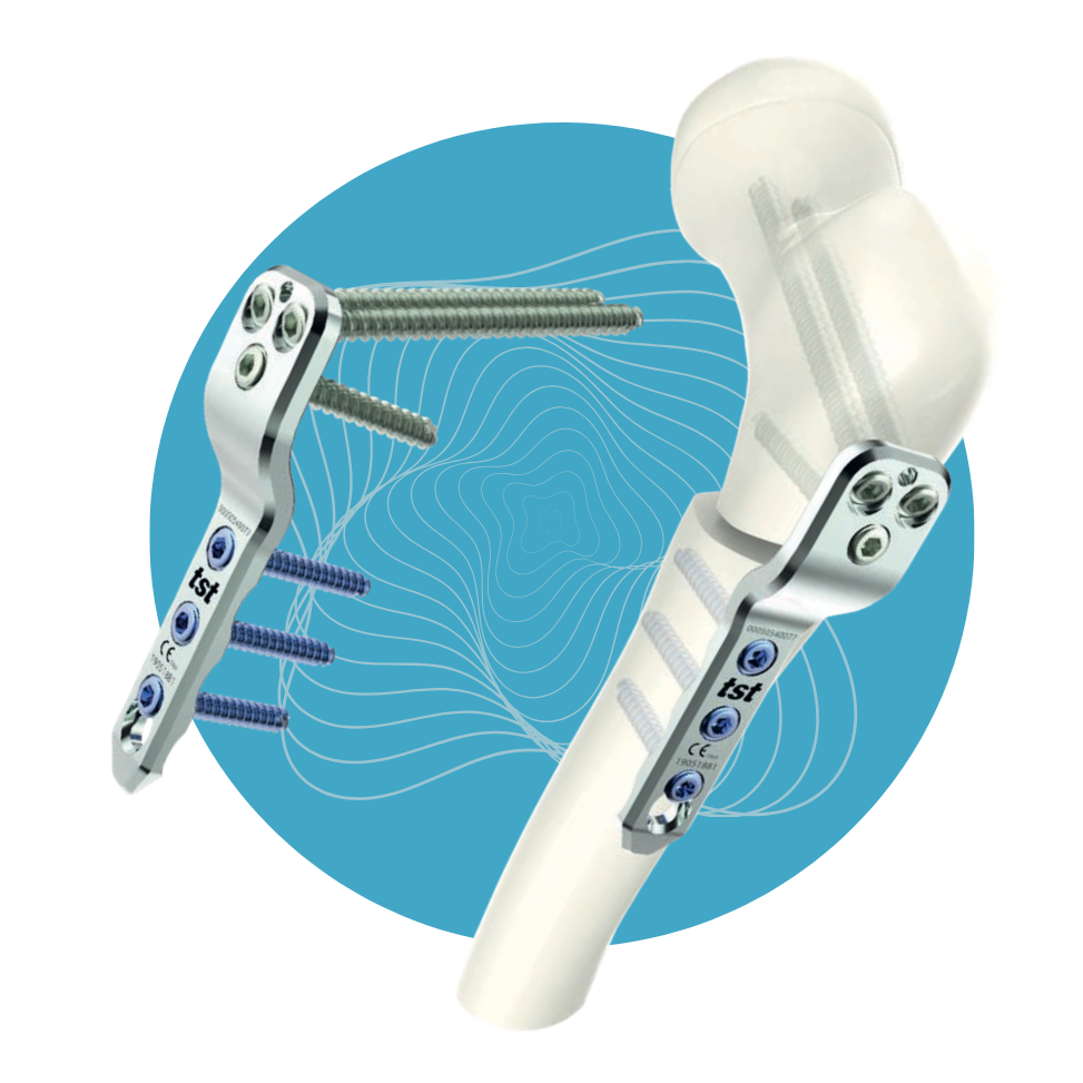 PD-04 - Set de Placas Pediátricas Titanio 3.5mm