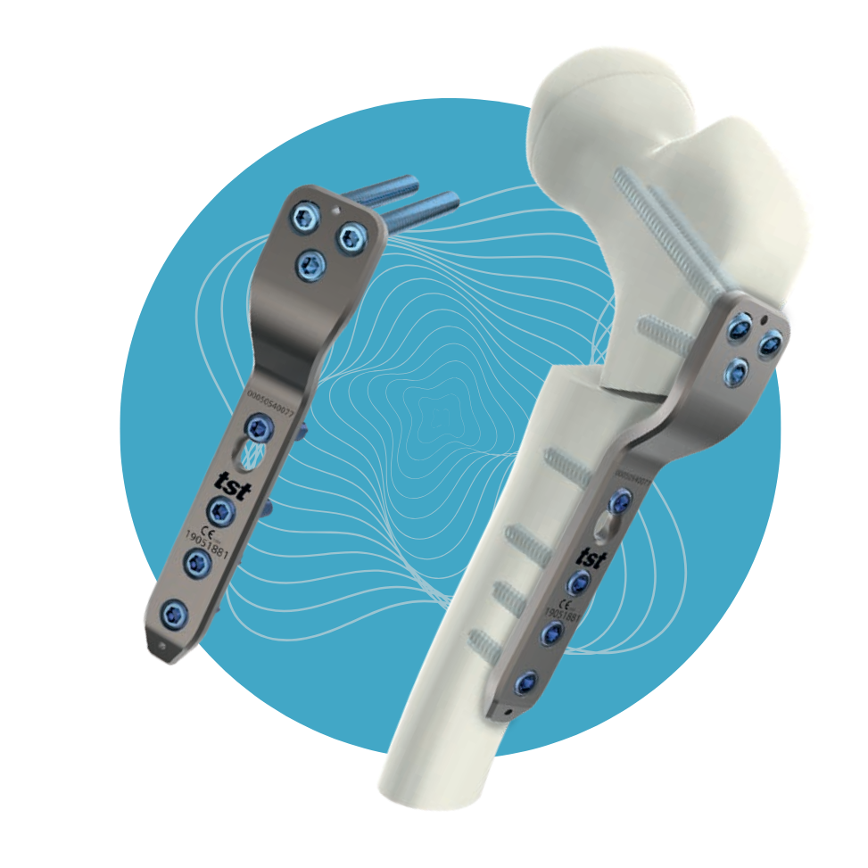 PD-06 - Set de Placas Pediátricas Titanio 4.5mm