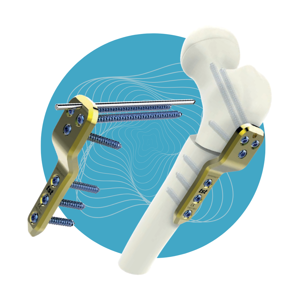 PD-08 - Set de Placas Pediátricas Titanio 2.7mm