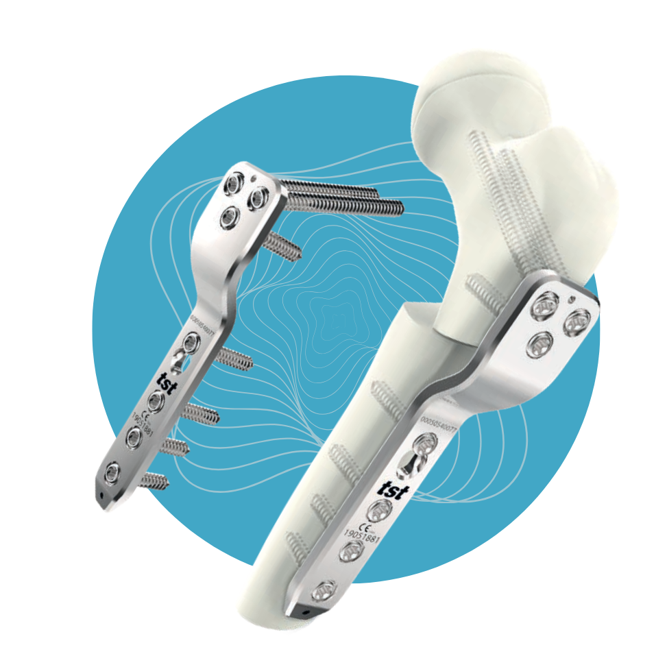 PD-12 - Set de Placas Pediátricas Acero Inoxidable 4.5mm