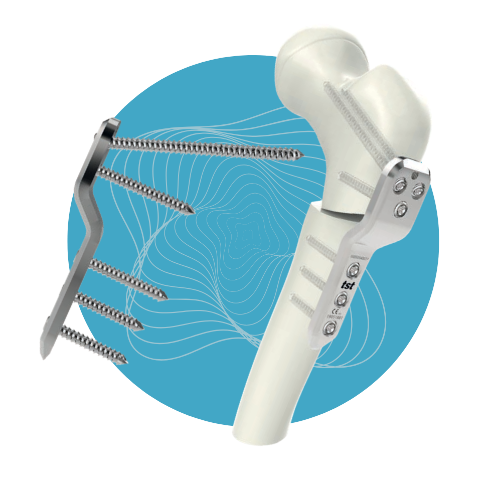 PD-13 - Set de Placas Pediátricas Acero Inoxidable 2.7mm