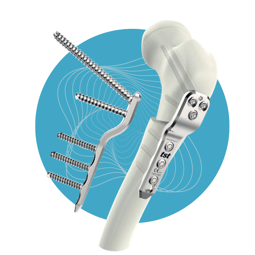 PD-14 - Set de Placas Pediátricas Acero Inoxidable 3.5mm